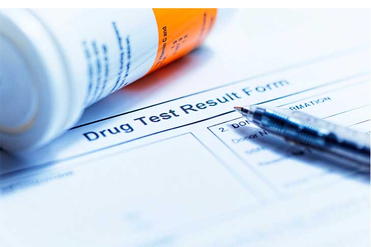 Drug Test-How Long Does Oxycodone Stay In Your System? | Oxycodone Half-Life