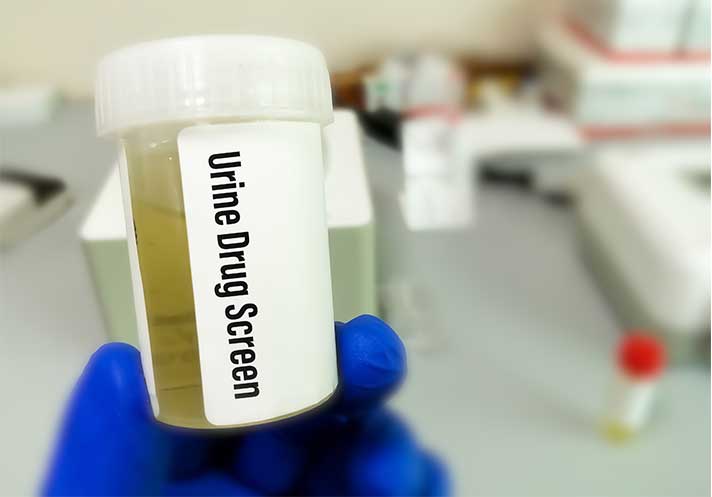 Dilaudid Urine Drug Test-How Long Does Dilaudid (Hydromorphone) Stay In Your System?