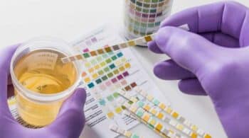 Urine Drug Test-Can You Still Get Hired If You Fail A Workplace Drug Test?