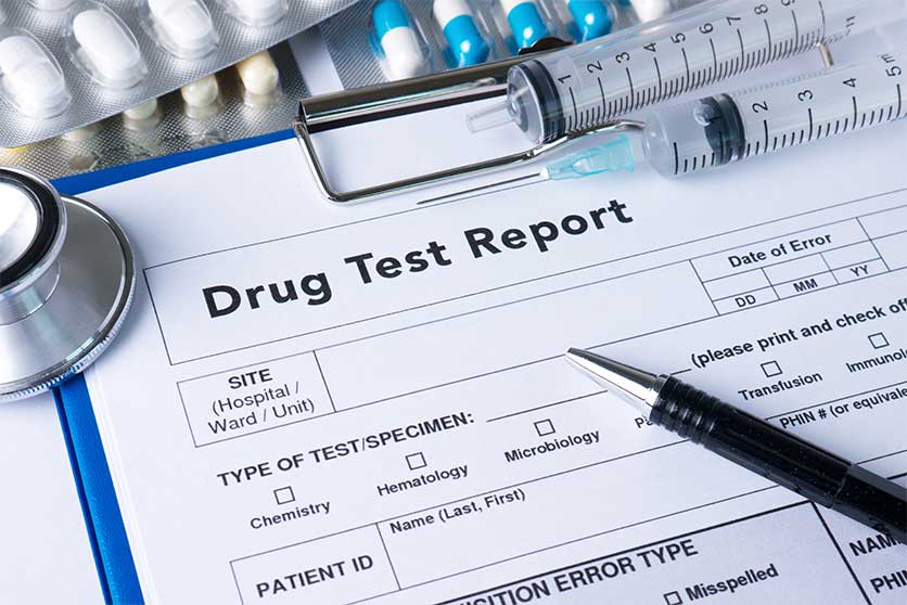 Drug Test Report-How Long Can Marijuana Be Detected In Your System?